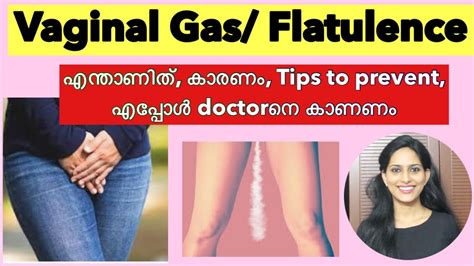 prolapse fart|Vaginal Gas: Causes, Prevention & Wh.